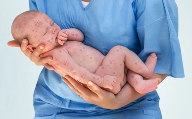 Baby mit Ausschlag beim Arzt, Kinderdermatologie, Neurodermitis