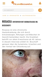 Article on rosacea