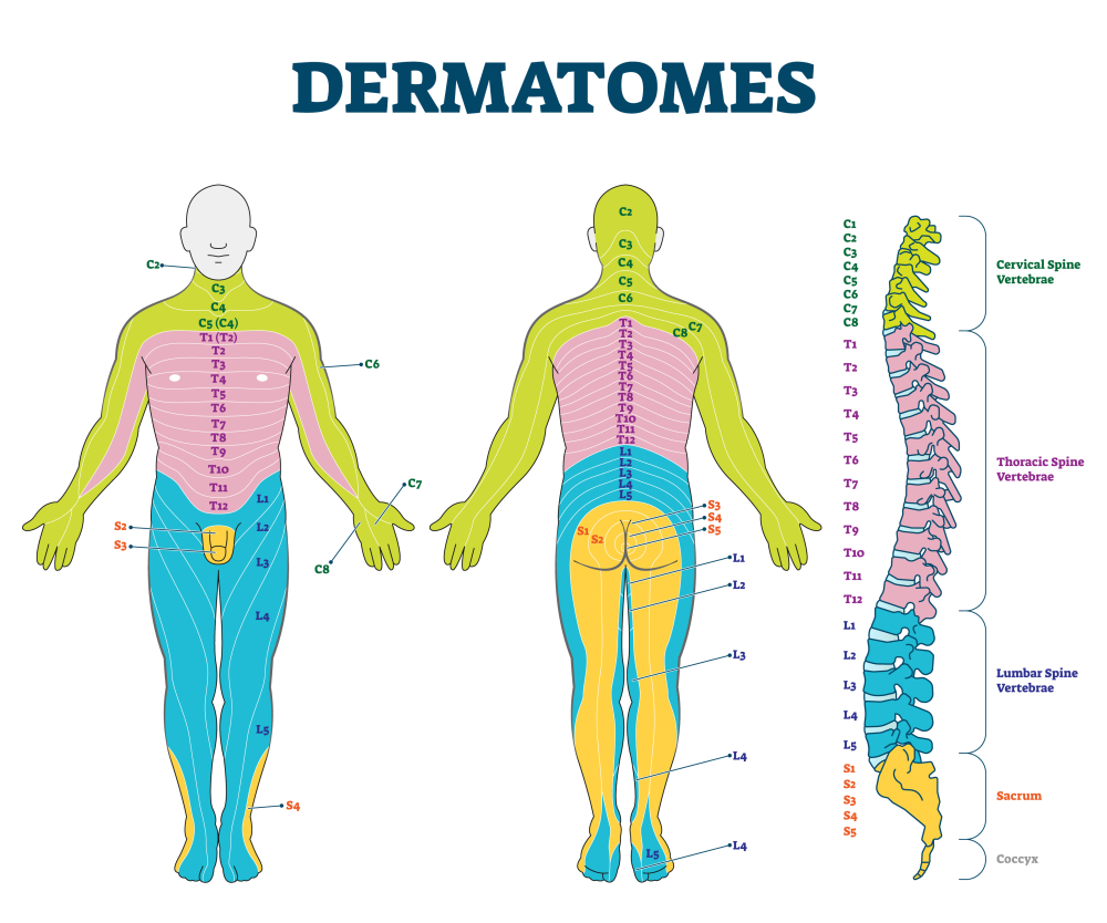 Herpes zoster - always dermatomes affected.