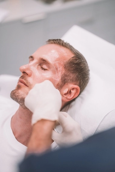 Ästhetische Behandlung bei einem Mann in der Hautarztpraxis Derma-Wien